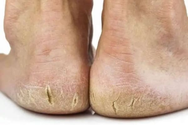 FeetHouse Podologia Sorocaba