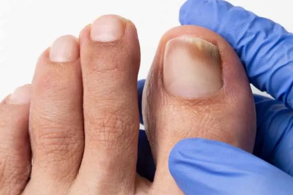 Feet House Podologia Sorocaba